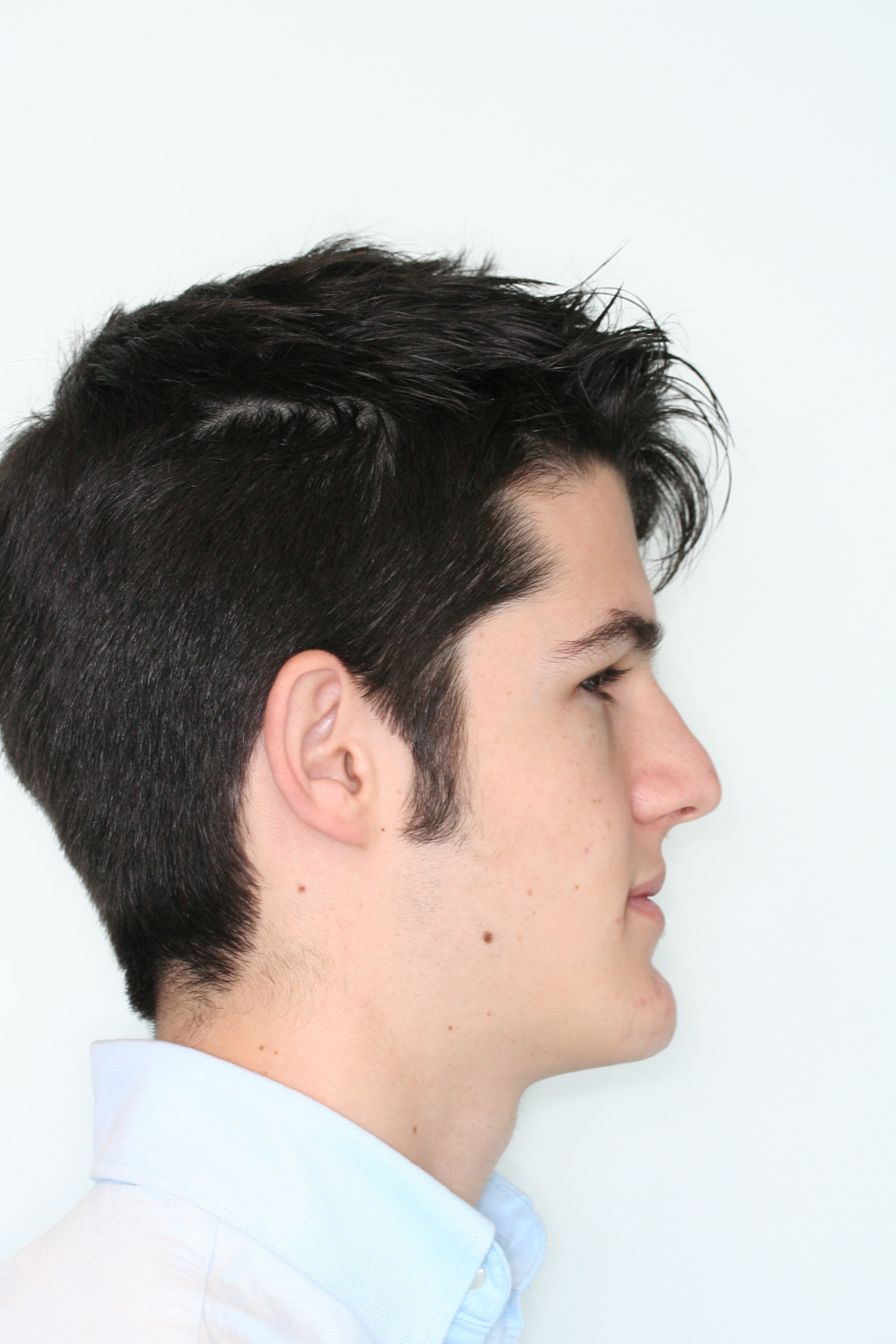 Before image